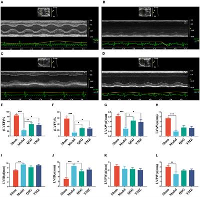 Qishen granules regulate intestinal microecology to improve cardiac function in rats with heart failure